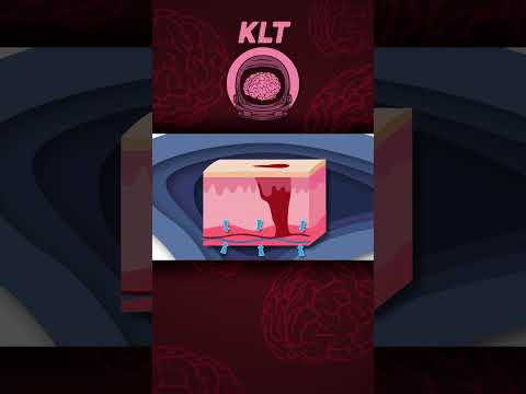 An Overview Of The Skin Healing Process! | KLT Anatomy #shorts