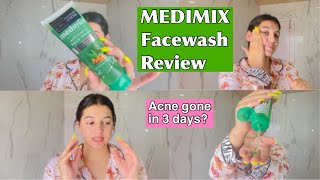 I used the medimix anti pimple facewash and here’s what happened | REVIEW